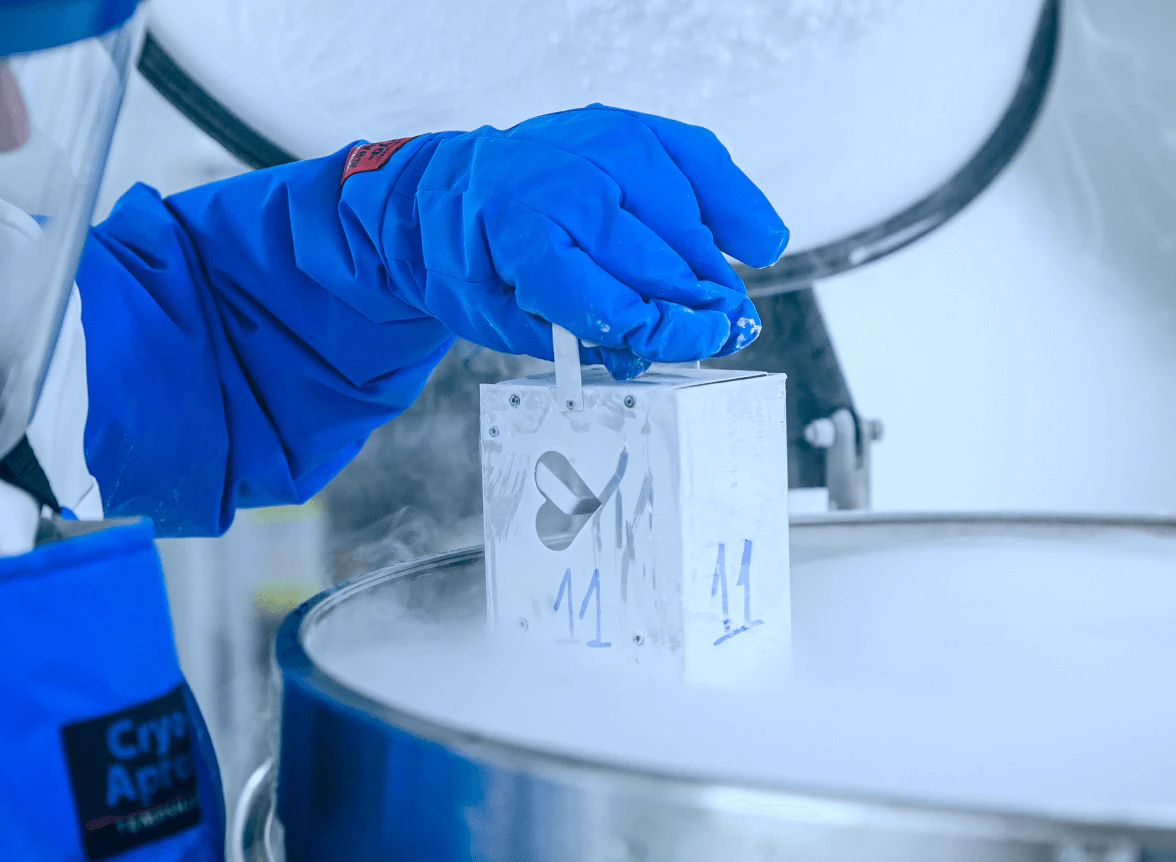 Técnico de laboratório usando luvas azuis inserindo bolsa de armazenamento etiquetada com sangue de cordão umbilical em tanque criogênico de nitrogênio líquido para preservação de células-tronco em ambiente hospitalar controlado
