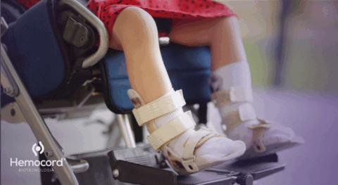 Análise global consolida evidências de 11 estudos sobre sangue de cordão na paralisia cerebral